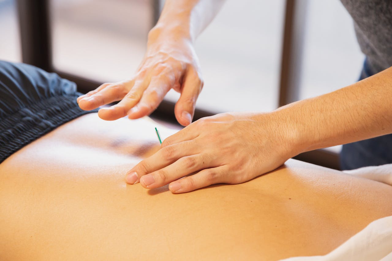 Acupuntura no tratamento da artrose: benefícios